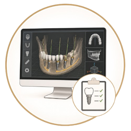 Digital Implant Planning